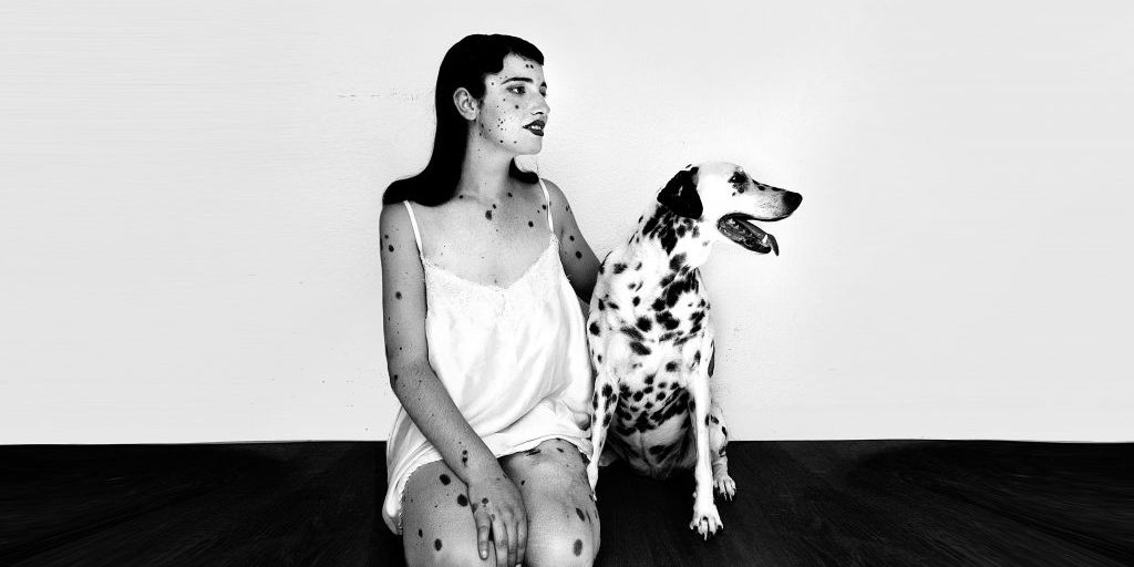 Dalmatians_Congenital-Melanocytic-Nevus_Spain-1024×854